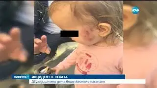 Дете нахапа друго в ясла, уволниха медицинска сестра - Новините на Нова (03.06.2016г.)