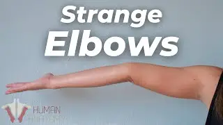 Women Have Weird Elbows...