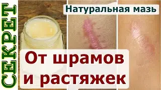 Натуральное средство для разглаживания шрамов и растяжек