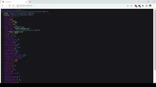 Symfony HttpClient. Простой запрос ответ методом Get