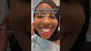 My Ortho Put A Belt Across My Teeth!!?!? 😩 Orthodontist Reacts...
