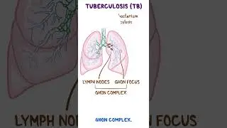 Clinical Cuts: Mycobacterium tuberculosis