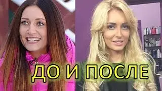 УЧАСТНИЦЫ ДОМ 2 ДО И ПОСЛЕ ПЛАСТИЧЕСКИХ ОПЕРАЦИЙ