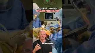 Hip Replacement with No Muscle Cutting 🔪 #shorts