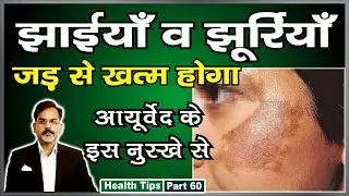 झाइयों और झुर्रियों को तुरन्त जड़ ख़त्म करें आयुर्वेद के इस नुस्खे से