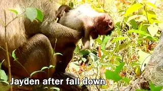 Hot new@1:45 pm Jayden fall down from tree make very low breath,she has seizures every few minute