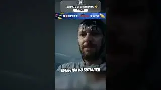 У него самые плохие волосы 😢