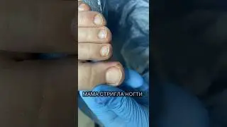 ВОТ ЧТО БЫВАЕТ, ЕСЛИ СТРИЧЬ УГОЛКИ 😱 