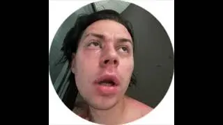 😢 САНЕЧКЕ FRAME TAMER’У СТАЛО ПЛОХО ПОСЛЕ ПОСЛЕДНЕГО СТРИМА