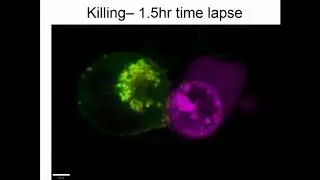 Natural Killer (NK) Cell Deficiency