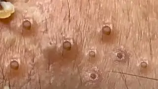 Most Satisfying and Relaxation with An Spa Video 