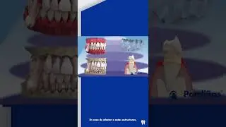 PROBLEMAS que provoca el SARRO DENTAL 