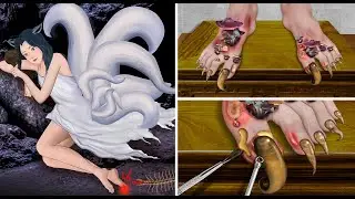 ASMR Treatment ingrown nails, swollen feet for a beautiful nine-tailed fox, deep clean treatment