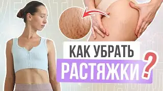 КАК УБРАТЬ РАСТЯЖКИ на ТЕЛЕ? Всё что нужно знать о растяжках на коже + СЕКРЕТНАЯ ТЕХНИКА