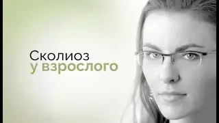 Сколиоз у взрослого человека: можно ли изменить угол?