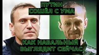 КАК ВЫГЛЯДИТ НАВАЛЬНЫЙ СЕЙЧАС