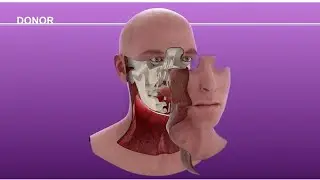 Cameron Underwood Face Transplant Surgical Animation 2018