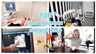 🤰Едем на УЗИ👫Пол малыша👼дневник беременности🍼второй скрининг👶гадание по нитке и иголке