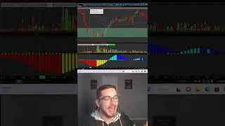 How To Catch The Exact Top & Bottom Using Supply & Demand 