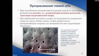Пропедевтика стом. заболеваний. Реставрация зубов композитными материалами