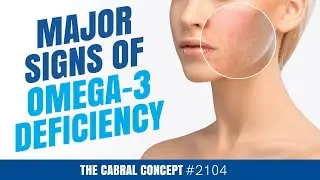 Major Signs of Omega-3 Deficiency | Cabral Concept 2104