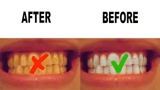 PHOTOSHOP İLE DİŞ BEYAZLATMA (Photoshop Dersleri)