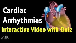 NEW: INTERACTIVE Animation with Quiz: Cardiac Arrhythmias