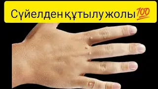 Сүйелден Құтылыңыз!