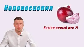 Колоноскопия. Почему необходима хорошая подготовка? Необычная находка в кишечнике при колоноскопии