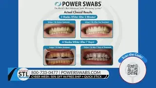 Power Swabs Offers 50% off Teeth Whitening