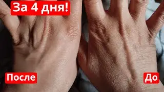 Омолодить и подтянуть кожу за 4 дня! И помолодеть на 10 лет! Недорогие аптечные средства для кожи.