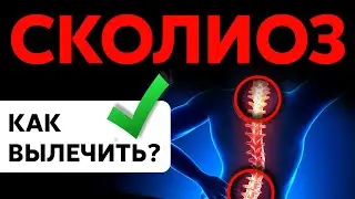 Как вылечить СКОЛИОЗ?