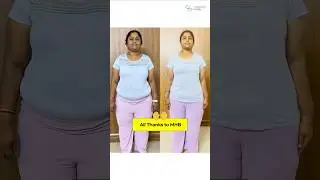 18 kgs Weight Loss with Home Workout and MHB Fat Loss Plan