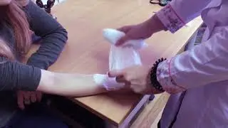 Оказание первой помощи при ожогах