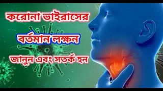 বর্তমান করোনা ভাইরাসের লক্ষণ| ডা. মো: আহাদ হোসাইন | kurmitola general hospital