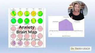 What Does an Anxiety Brain Map Look Like? (w/Dr. Trish Leigh)