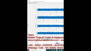 Rolling element fault classification using KNN - bearing fault - knn - matlab - FAULT - Simulink