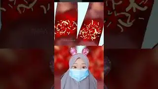 Infeksi Karena Cincin Yang Sempit 😱 