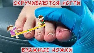 Wet Feet Pedicure / Arched Toe Nails