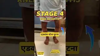 Ghutne ka operation kab karana chahiye ⁉️