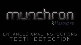 Munchron Cavity App for Android - Find Teeth Cavities with your Phone!