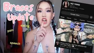 Braces Vlog Ep.2: Braces process update, expanders, underbite brace face, what i have been eating