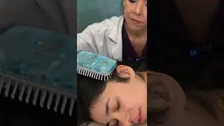 Asmr scalp tingles 