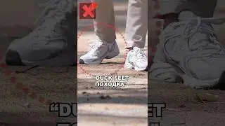 К ЧЕМУ ПРИВОДИТ "DUCK FEET" ПОХОДКА ?