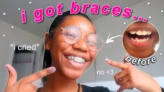I GOT BRACES...| braces vlog | pain level & coping with braces *i cried*