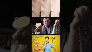জেনে নিন খুব সহজে কিভাবে ফর্সা হতে পারবেন 😳। 
