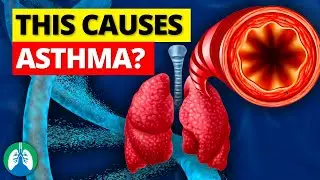 THIS is the Strongest Predisposing Factor for Asthma