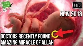 DOCTORS FOUND AMAZING MIRACLE OF ALLAH INSIDE WOMB (NEW 2018)