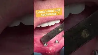 Loose Multi Unit Abutments 