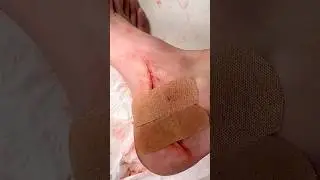 Fake blood / Wound trick using cinematic makeup 